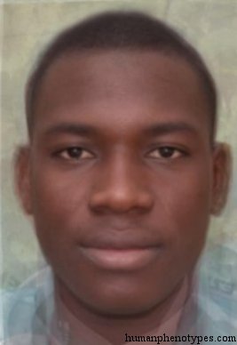 <p>Identify this Phenotype</p>