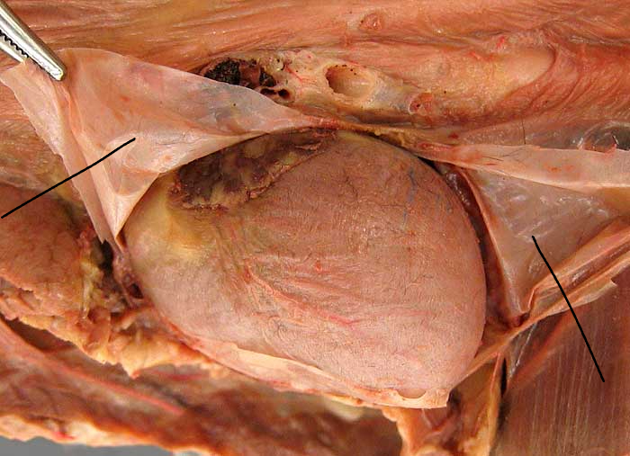 <p>Protects heart from damage and holds it in place</p>
