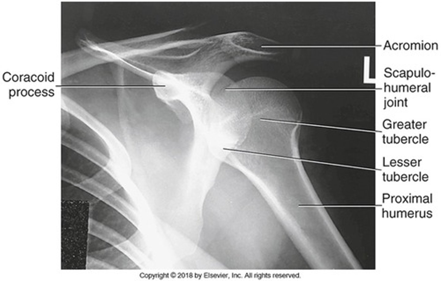 <p>- collimation includes superior scapula, lateral half of clavicle, and proximal humerus</p><p>- lesser tubercle</p><p>- greater tubercle</p>