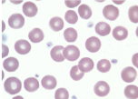 <p>thrombocyte</p>