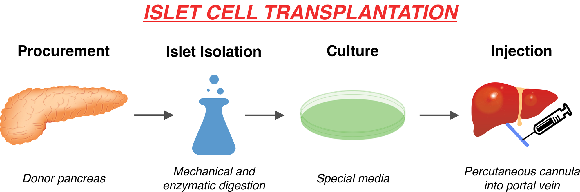 <p>tx=beta cell transplant + immunosuppressant drugs forever ex tacrolimus (T-cell suppression)</p><ul><li><p>2-3 infusions of islet cells required (over time)</p></li><li><p>challenges=donor numbers, chronic immunosuppression</p></li></ul><p></p>