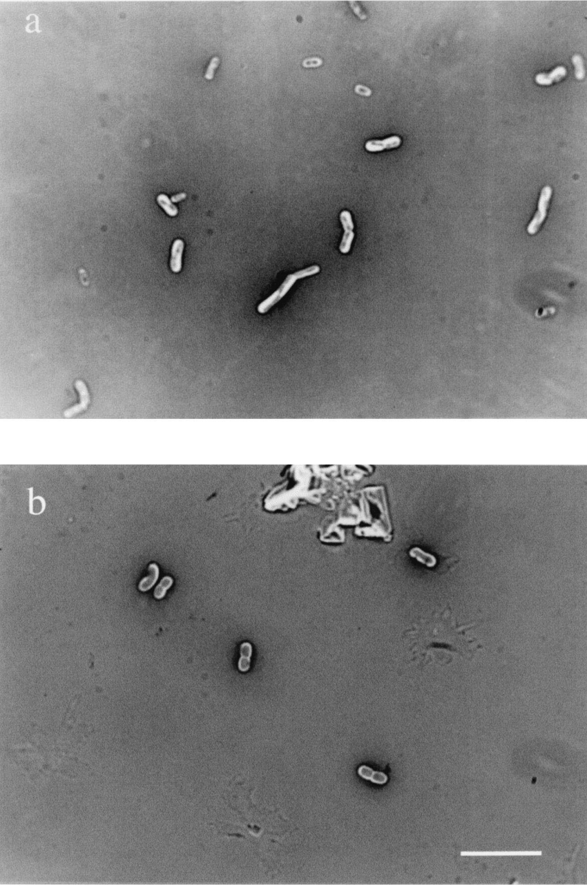 <p>simple stain used in bright field micrscopy </p><p>→ single dye to stain BACKGROUND </p><p>→ cells repel dye (H+) and are left unstained </p><p>→ silluthote apperance </p>