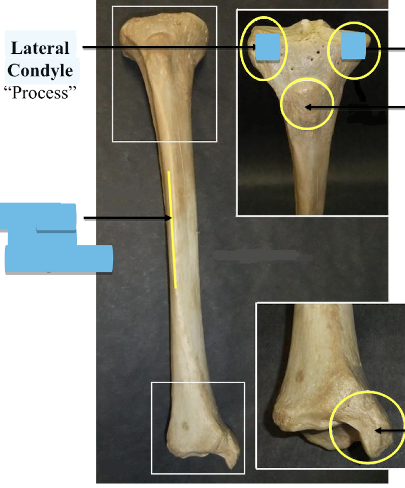 <p>Lateral Condyle </p>