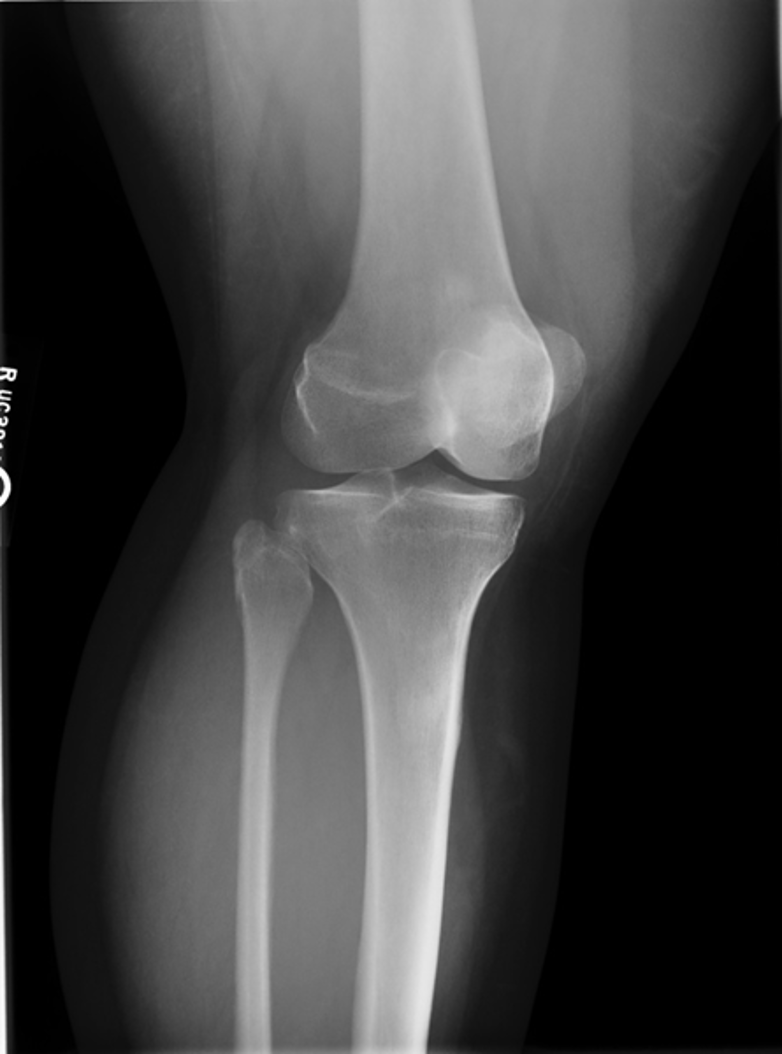 <p>what is the critique of this medial oblique?</p>