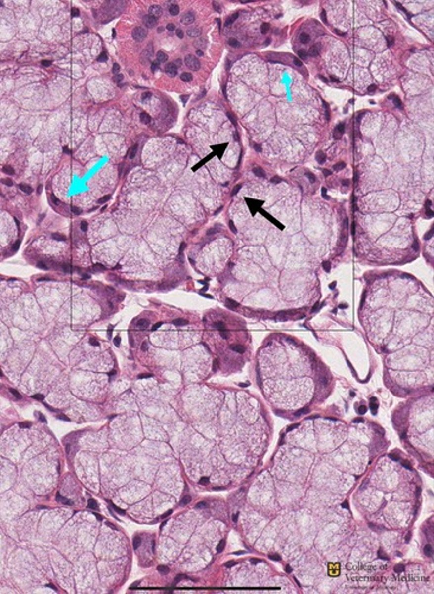 <p>What type of glandular epithelium is shown?</p><p>What structures are the respective arrows pointing to?</p>
