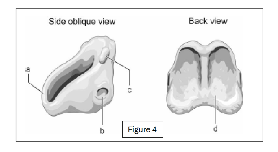 <p>label b - where does it connect to?</p>