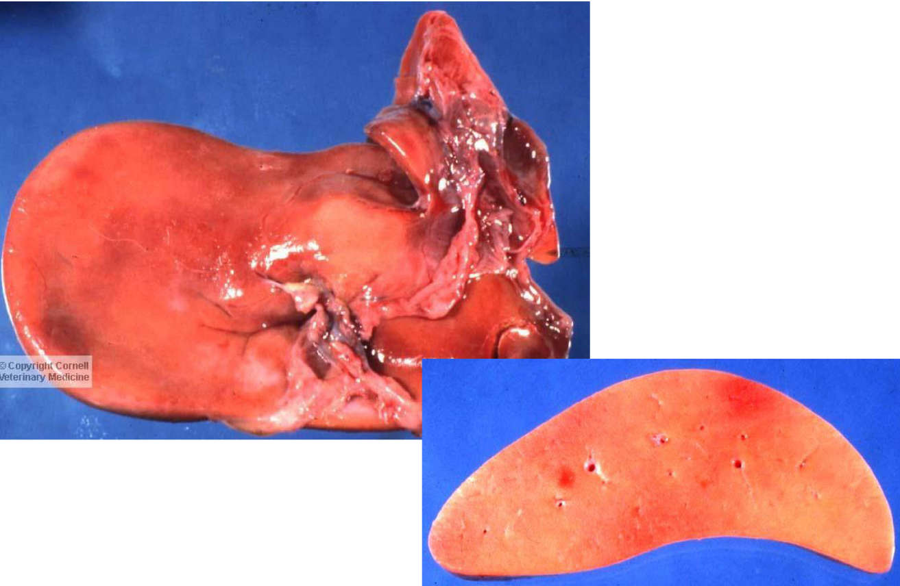 <p>what is being shown in this liver**</p>