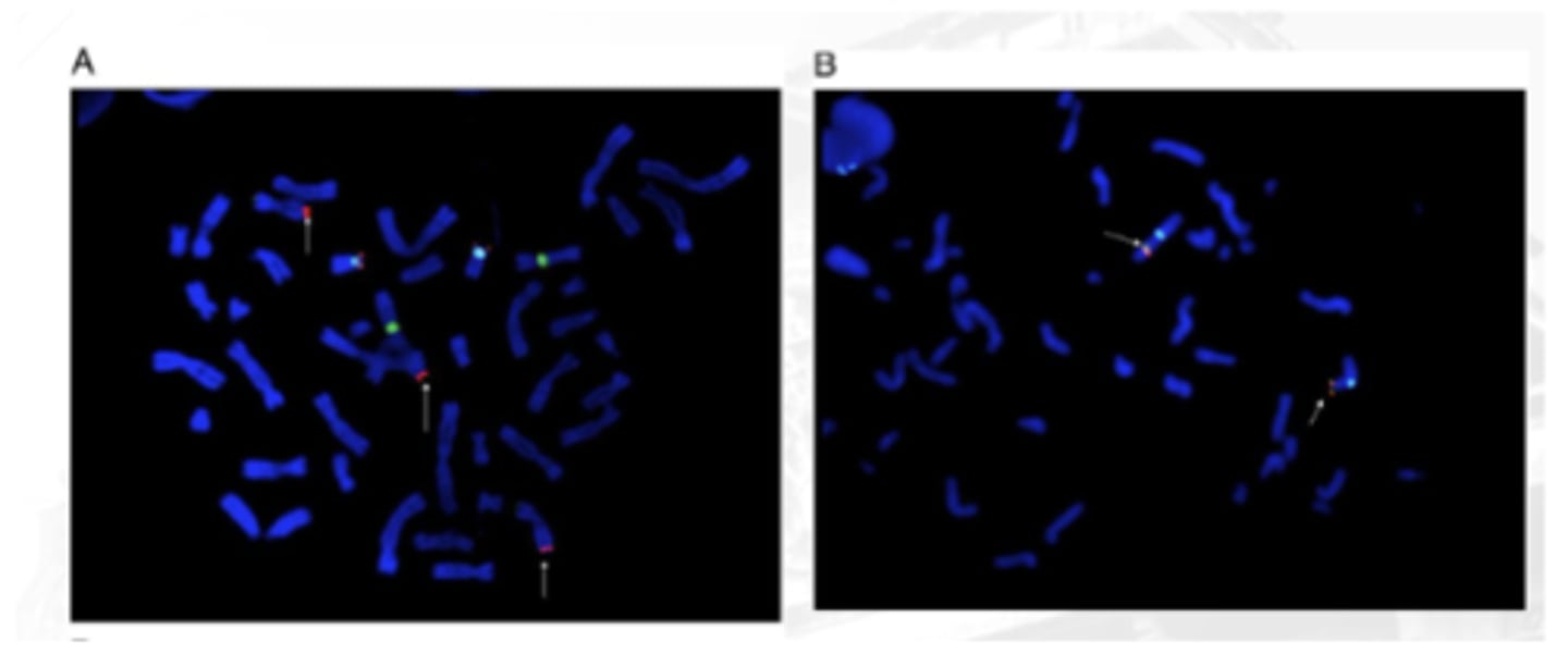 <p>Locate the subtelomere</p><p>Specific to the subtelomere region of chromosome</p><p>Useful in the detection of subtelomere deletions and rearrangements</p>