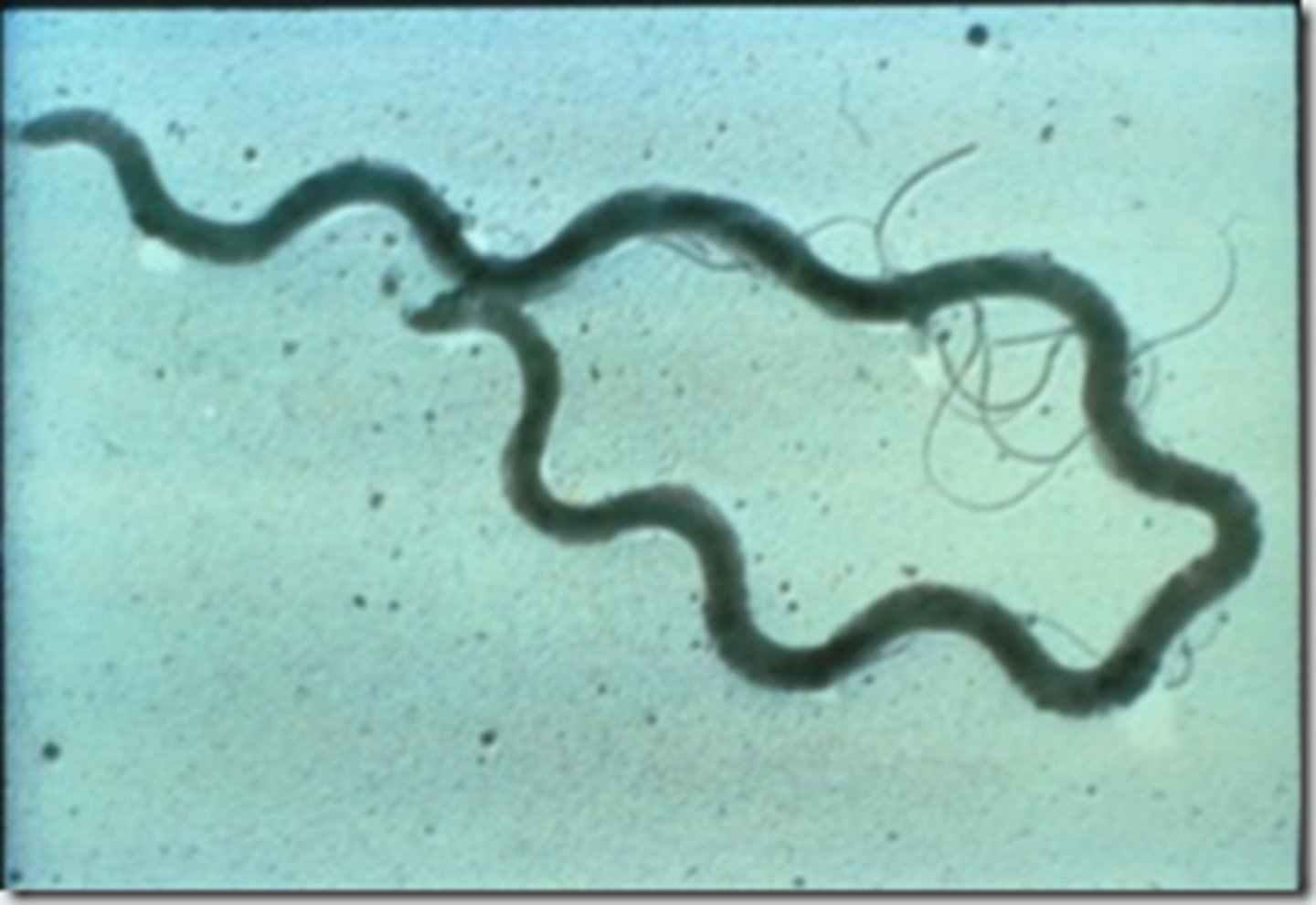 <p>infectious veneral disease caused by the Treponema pallidum spirochete</p>