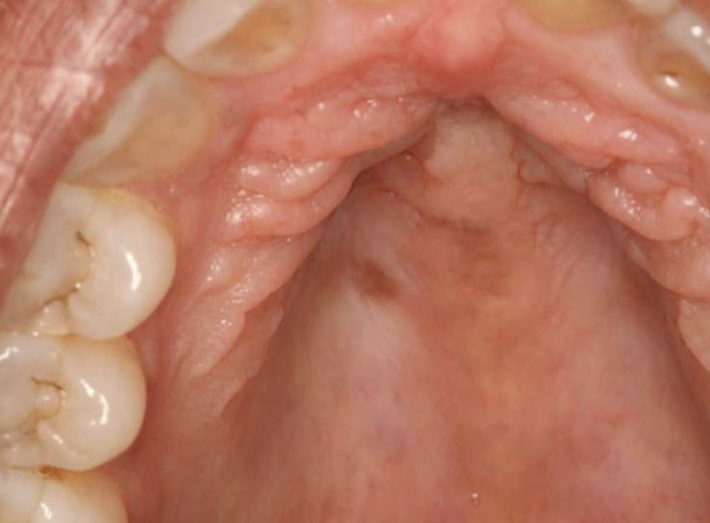 <p>What type of pigmented lesion?</p>