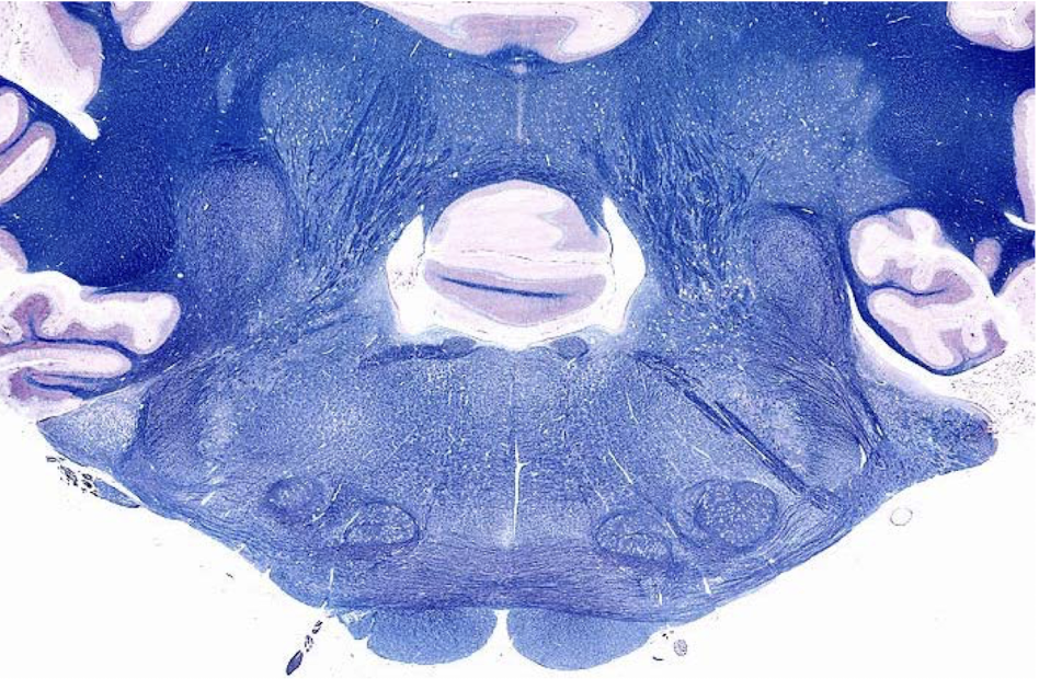 <p>what section of the brain is shown?</p>