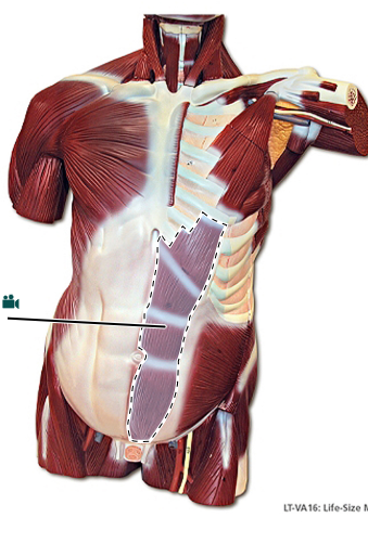 <p>origin of this muscle</p>
