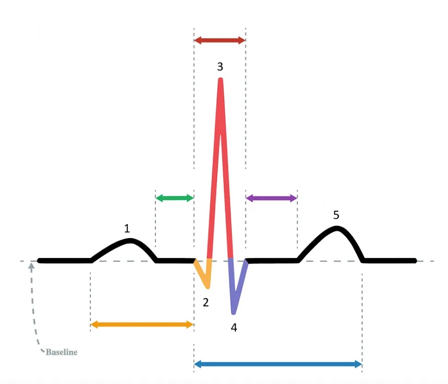 <p>Identify the part of the diagram where ventricular repolarization takes place.</p>
