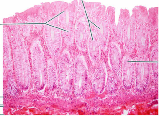 <p>Epithelium</p>