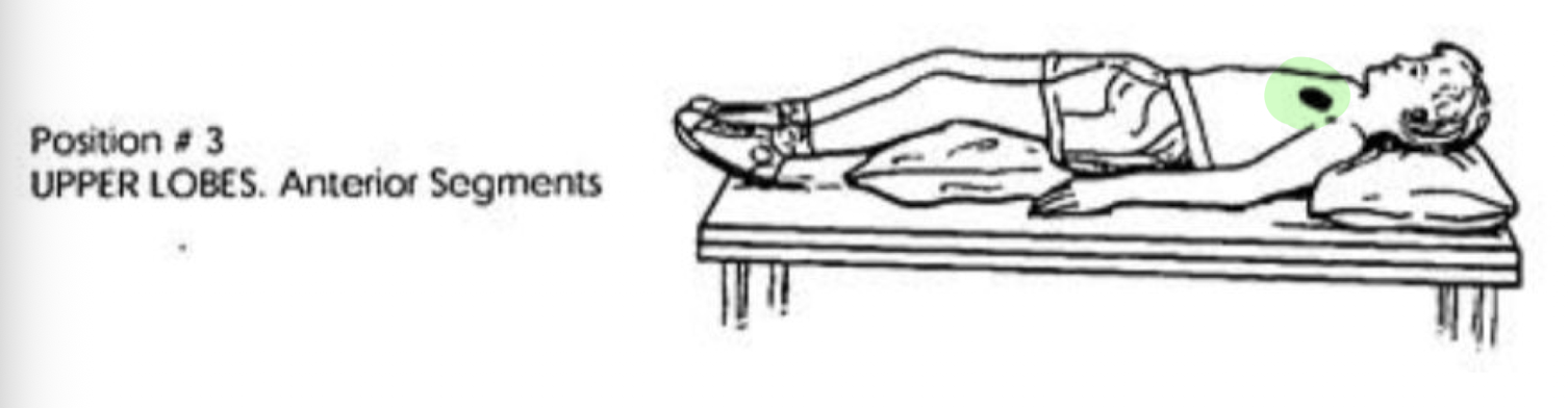 <ul><li><p>Supine with the Table Level </p></li></ul><p></p>