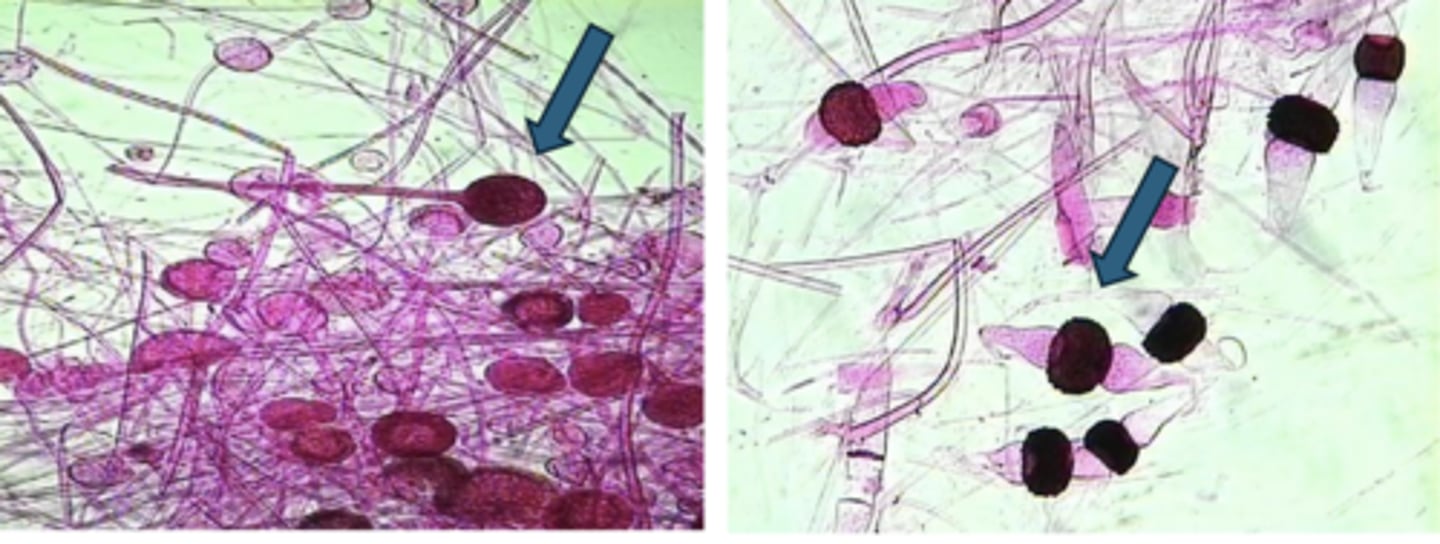<p>Rhizopus - (L) asexual (R) sexual</p>