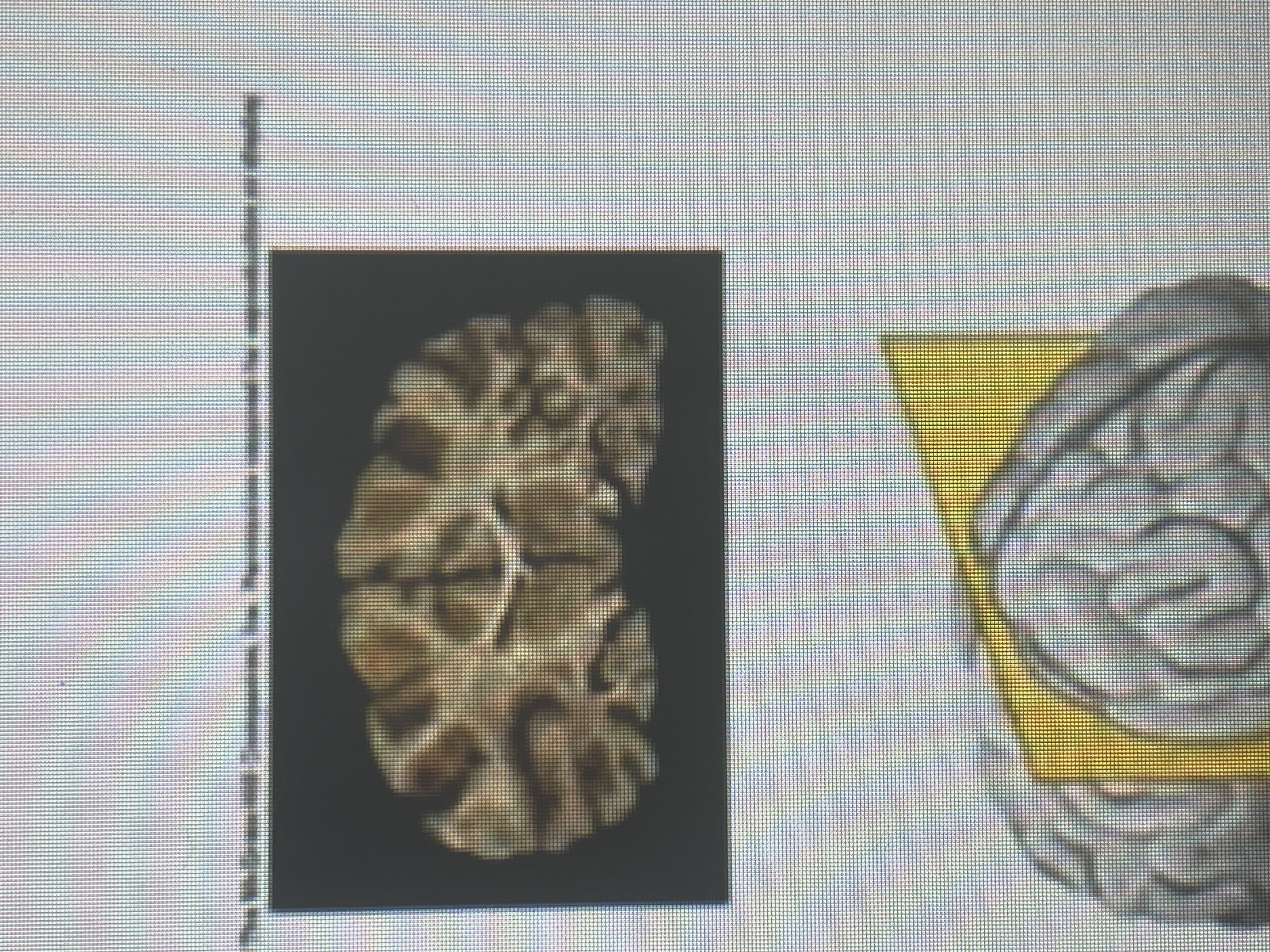 term image