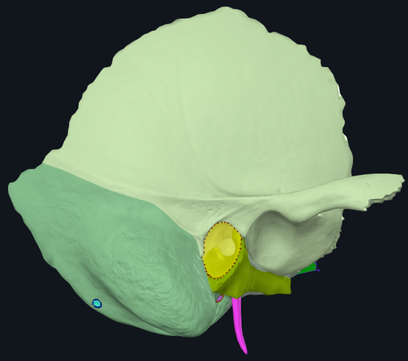 term image
