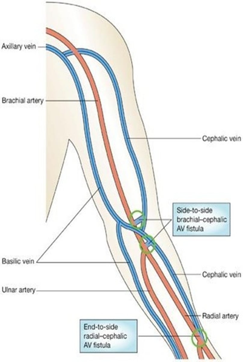 <p>The __________ is the preferred method of providing vascular access for hemodialysis in patients with end-stage renal disease</p>