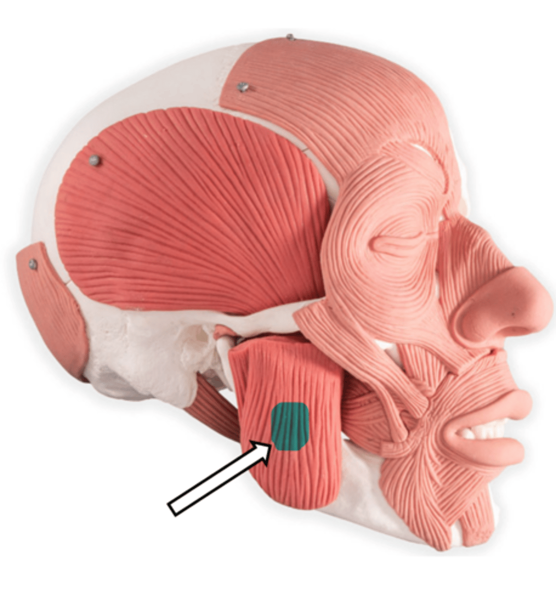 <p>name the muscle</p>