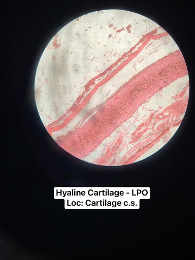 <p>Hyaline Cartilage Found in trachea</p>