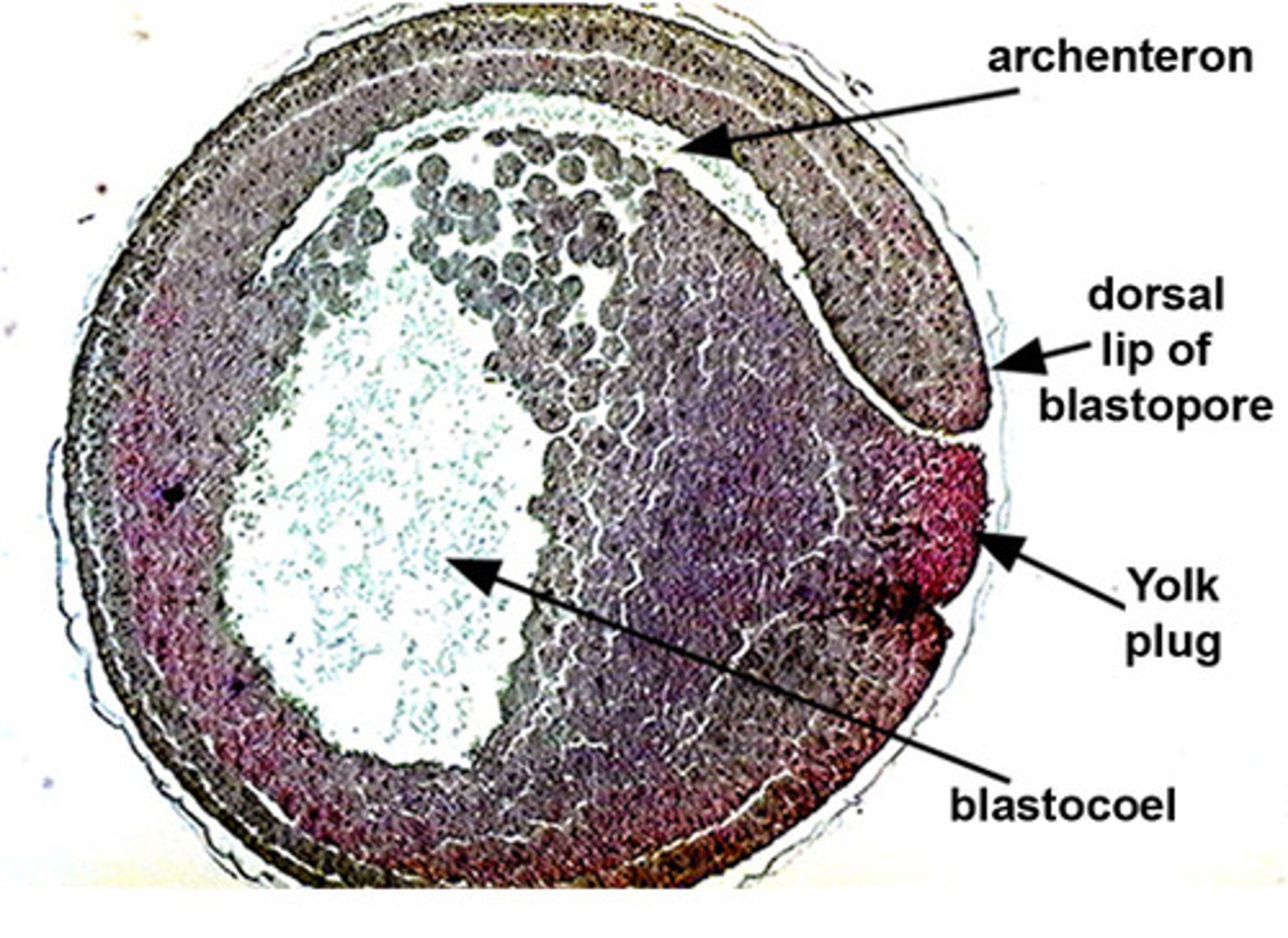 <p>dorsal lip</p>