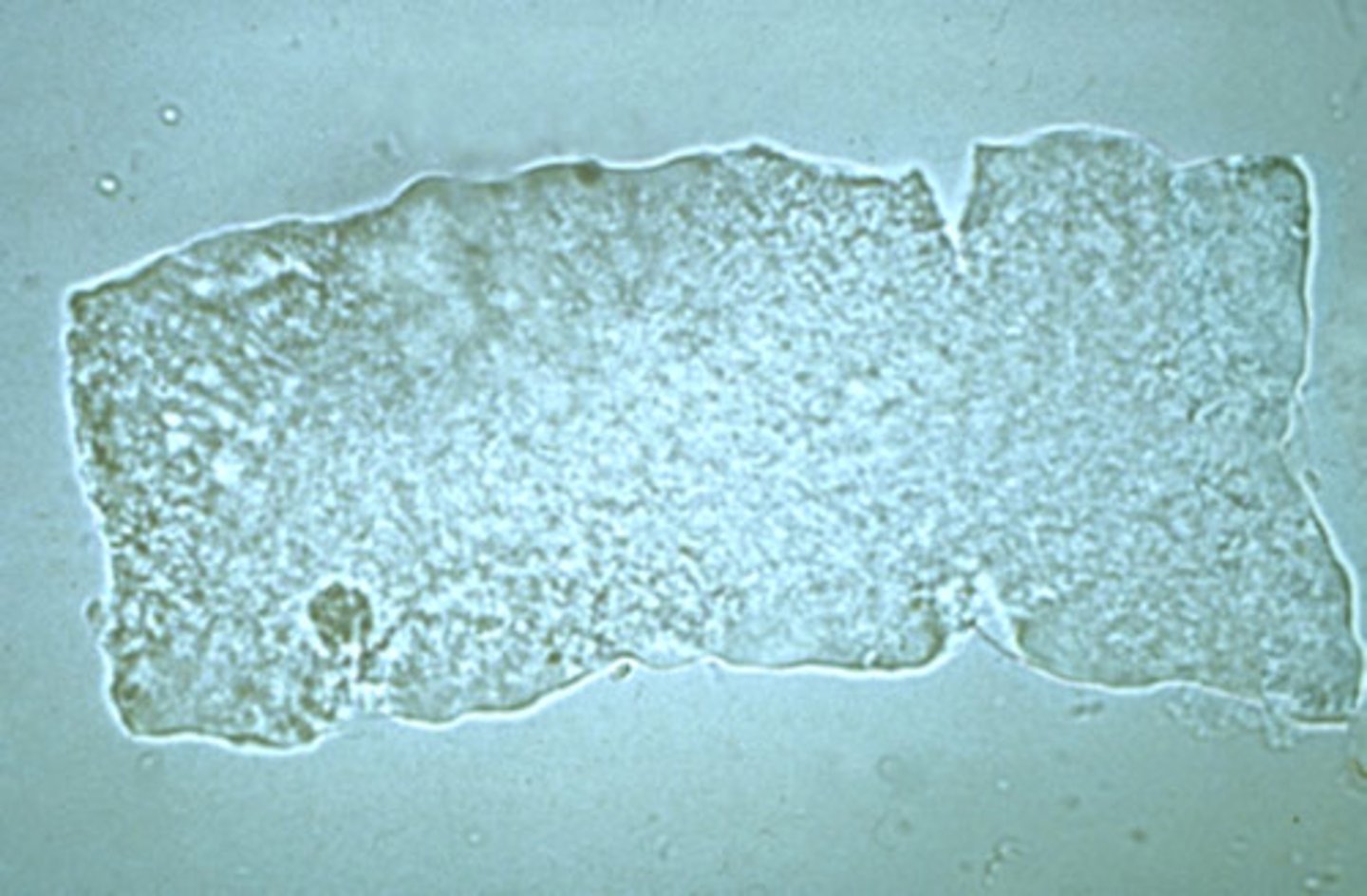 <p>wider than normal cast matrix</p><p>-sources of error= fecal material, fibers</p><p>-reporting= avg. # per lpf</p><p>-correlations= protein, WBCs, RBCs, granular casts, waxy casts</p>