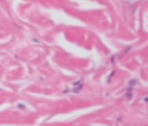 <p>Which type of tissue does this image depict?</p>