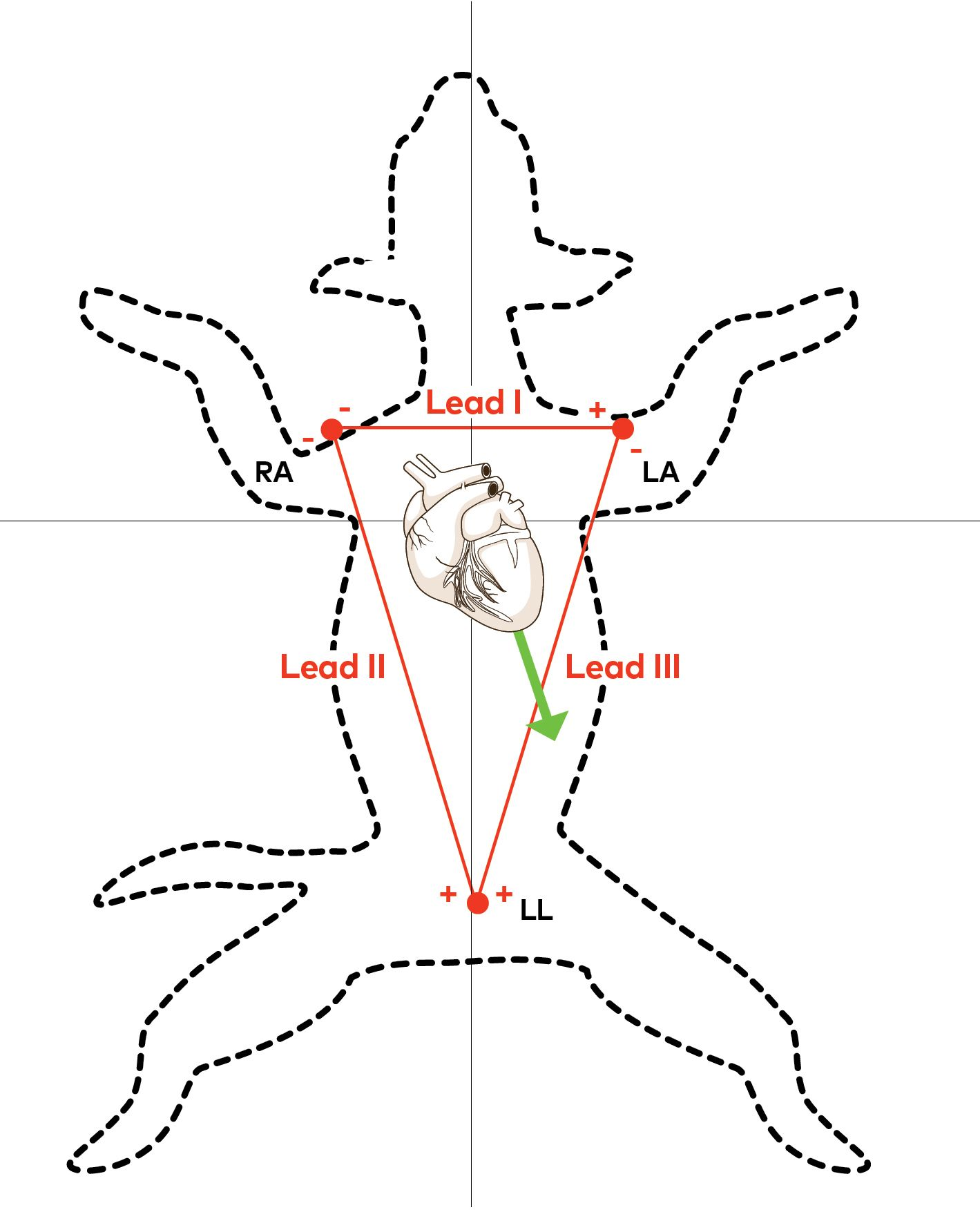 <p>lying in right lateral recumbency</p><p>gently restrain limbs</p><p>electrodes/pads should be placed on the limbs appropriately</p><ul><li><p>right forelimb</p></li><li><p>left forelimb</p></li><li><p>left hind limb</p></li></ul><p></p>