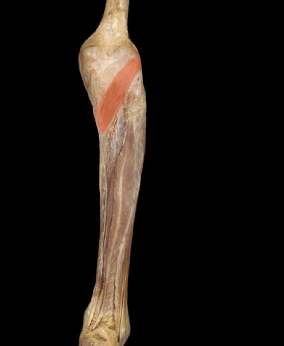term image