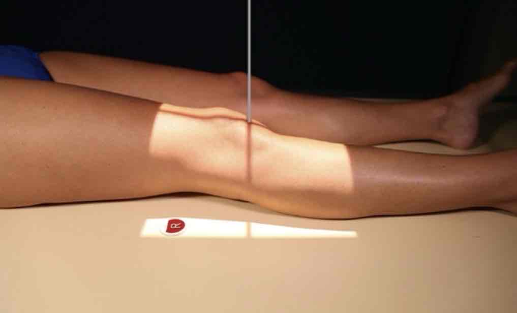 <p>What Projection is this?</p>