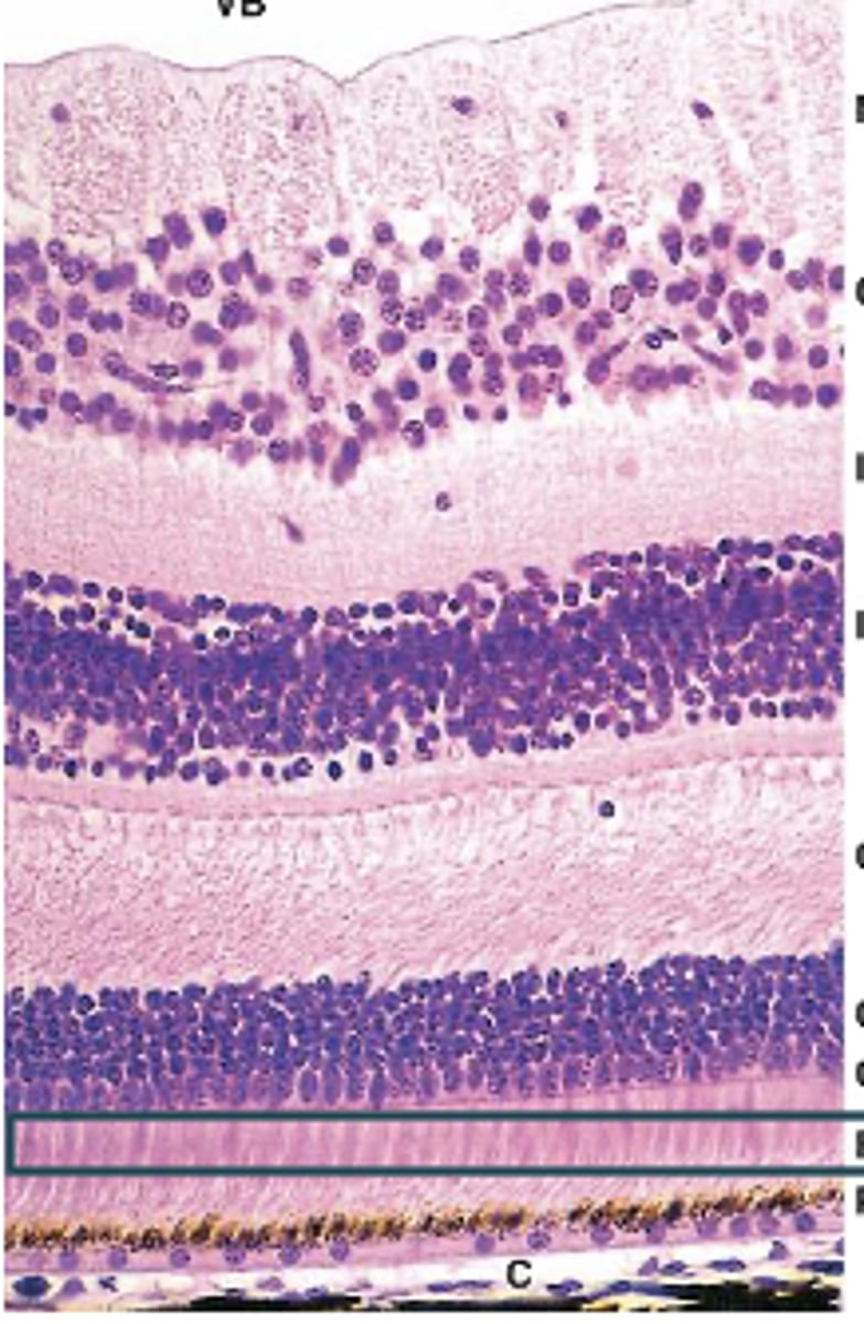 <p>Identify the Layers of the neural retina</p>