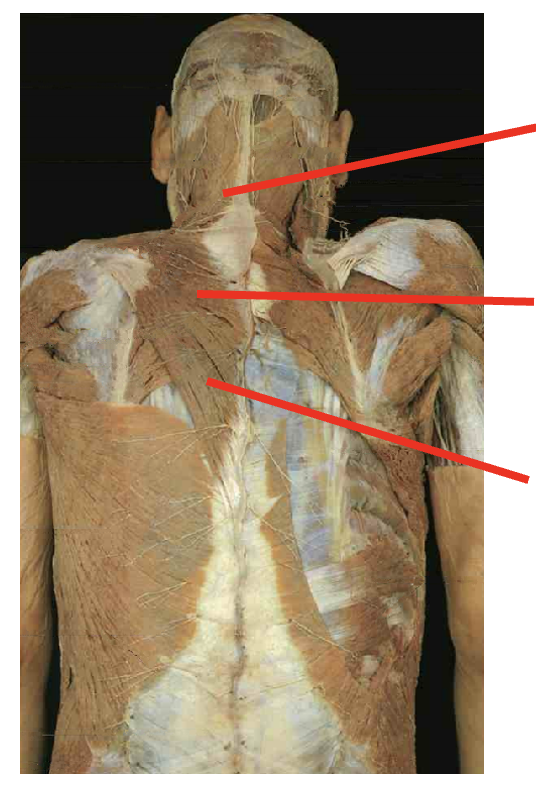 <p>What are these muscles. What is its origin. Where does it inserts. </p>