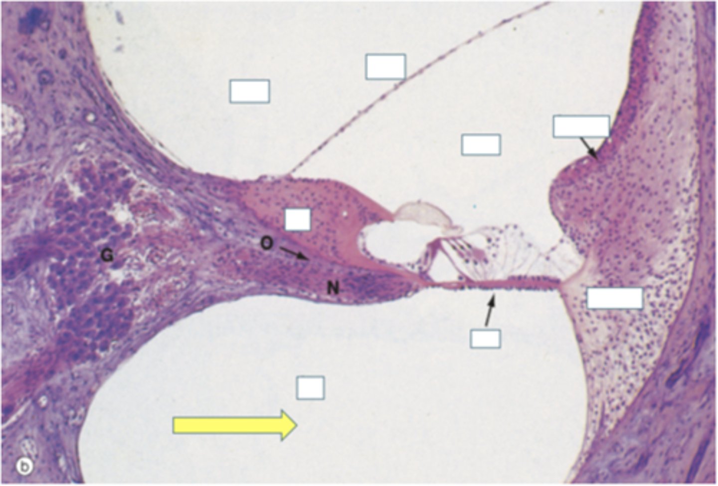 <p>Identify the structure</p>
