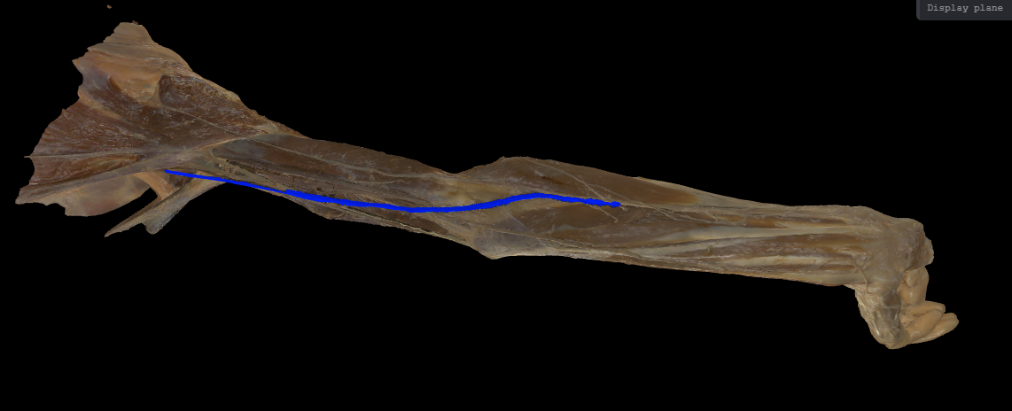 term image