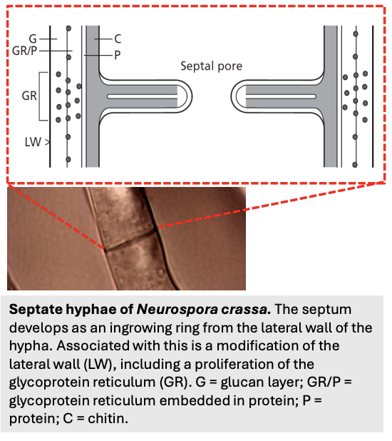 <ul><li><p><strong>Septum</strong></p></li><li><p><strong>Proliferation of glycoprotein reticulum</strong> (GR), glucan layer (G), proteins (P), chitin (C)</p></li></ul><p></p>