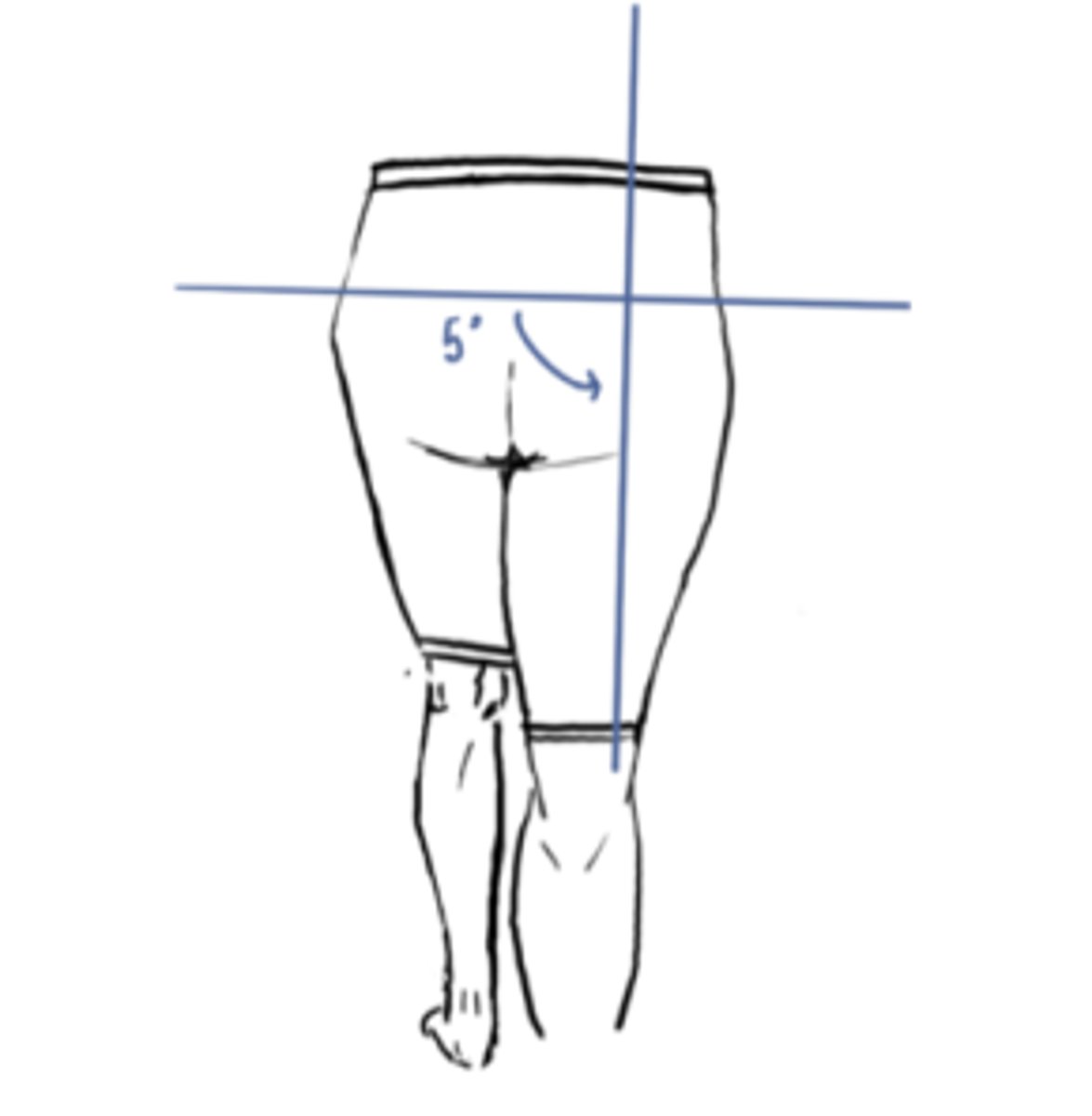 <p>IM: Abduction (Glute medius)</p><p>EM: Adduction</p><p>IM&gt;EM (concentric)</p><p>Angle = 2° abduction</p>