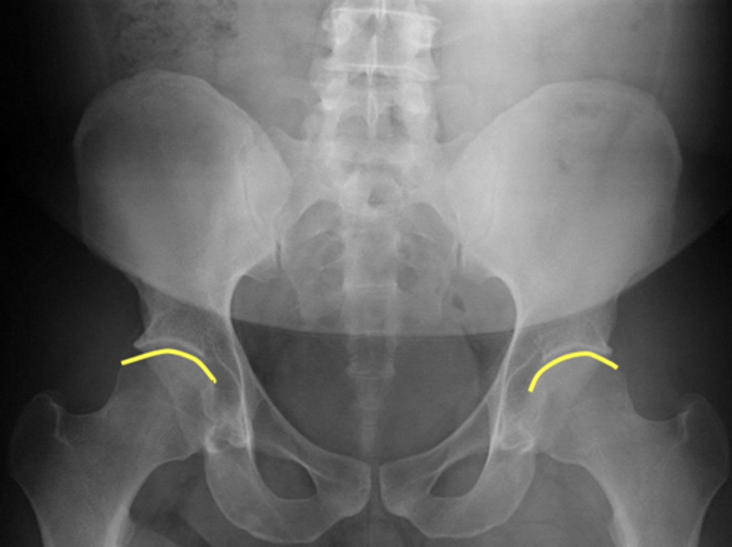 <p>What are outlined in yellow?</p>