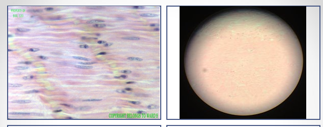 <p>Identify this tissue</p>
