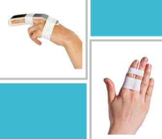 <ul><li><p>Buddy splint&nbsp;</p></li><li><p>finger strips/splints&nbsp;</p><ul><li><p>FO, PIP, DIP, Static, Pre-fab&nbsp;</p></li></ul></li><li><p>volar strut stabilization&nbsp;</p></li></ul><p></p>