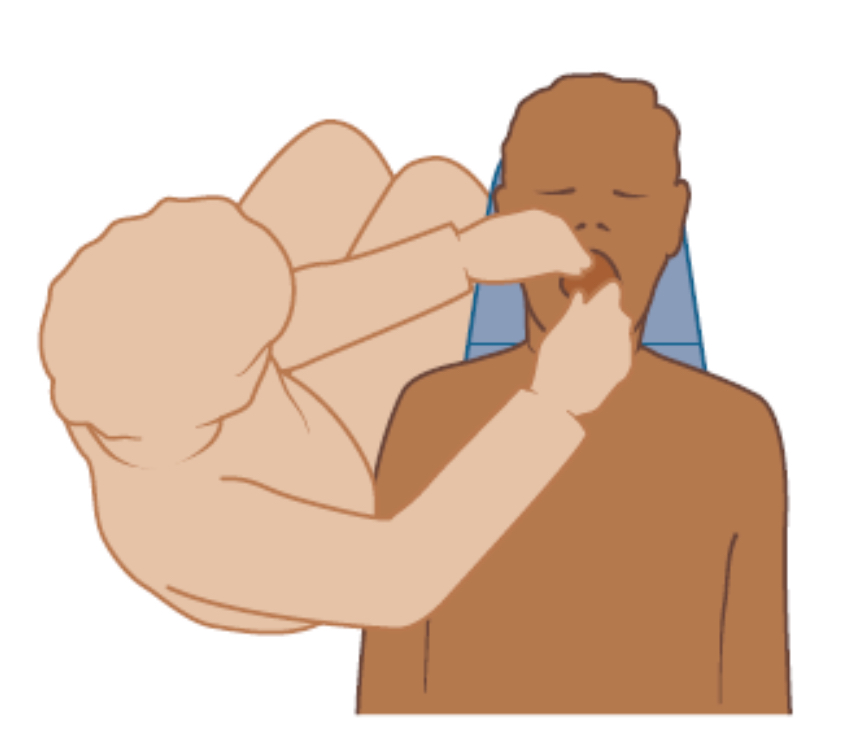 <p><strong>What clock position is this?</strong></p>