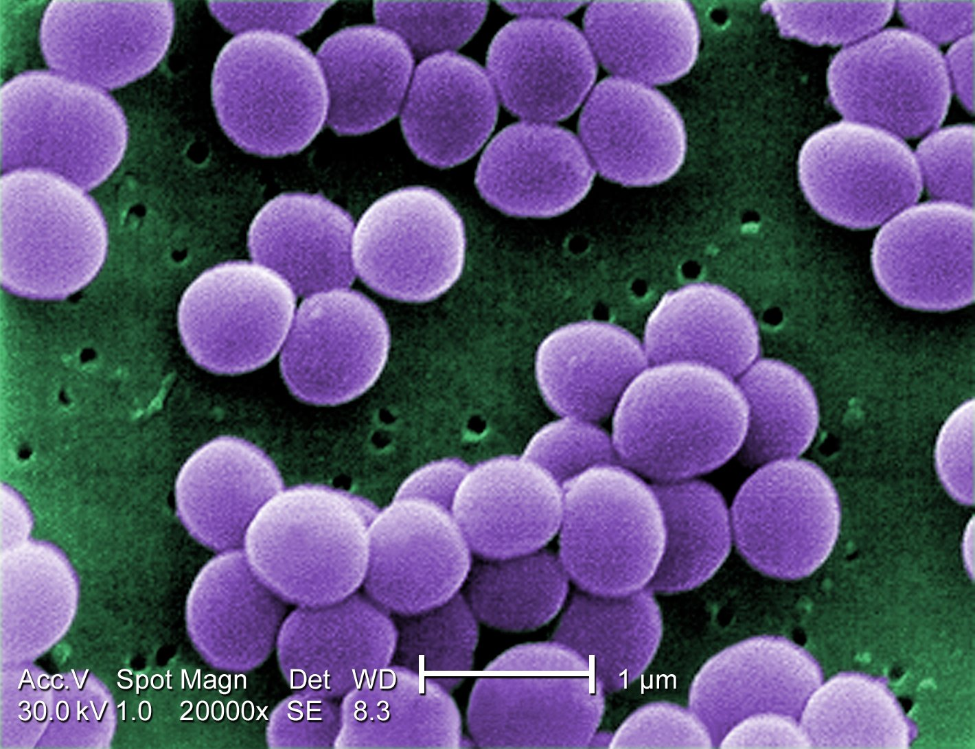 <p><em>Staphylococcus</em> aureus (Gram-positive bacteria) </p>