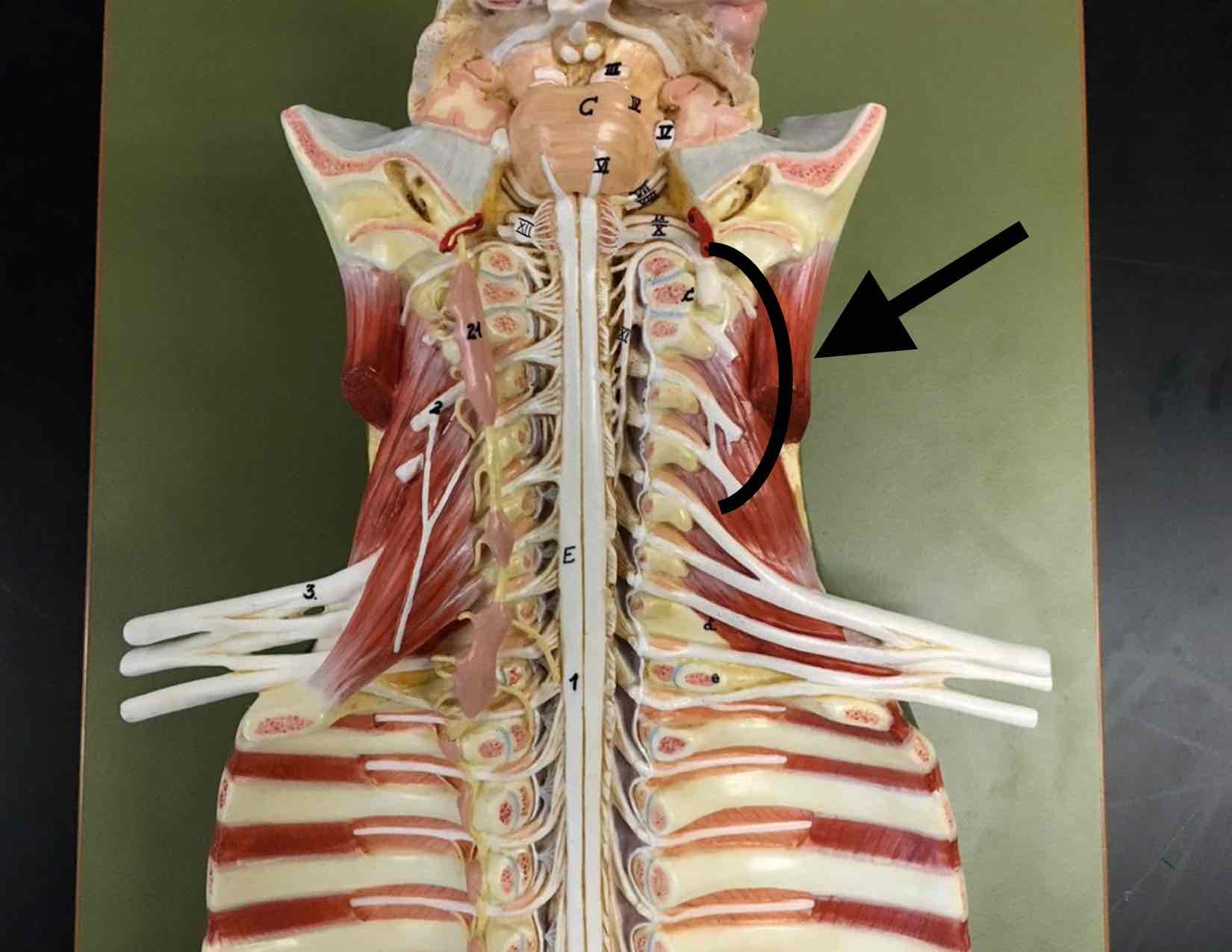 <p>name the specific cluster of white structures </p>