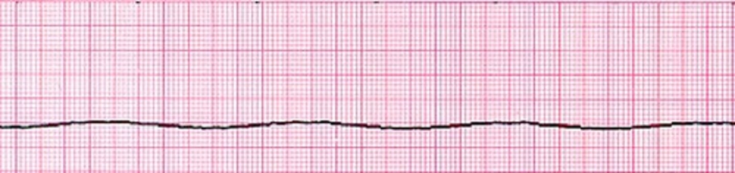 <p>administer CPR, epinephrine, consider vasopressin</p>