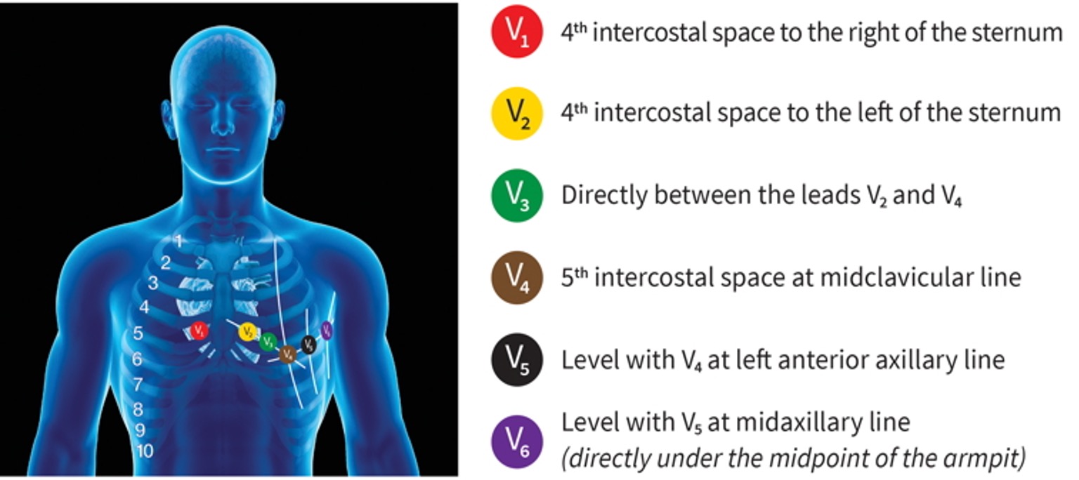 <p>unipolar leads which use central terminal as neg pole</p><p>V1-V6</p>