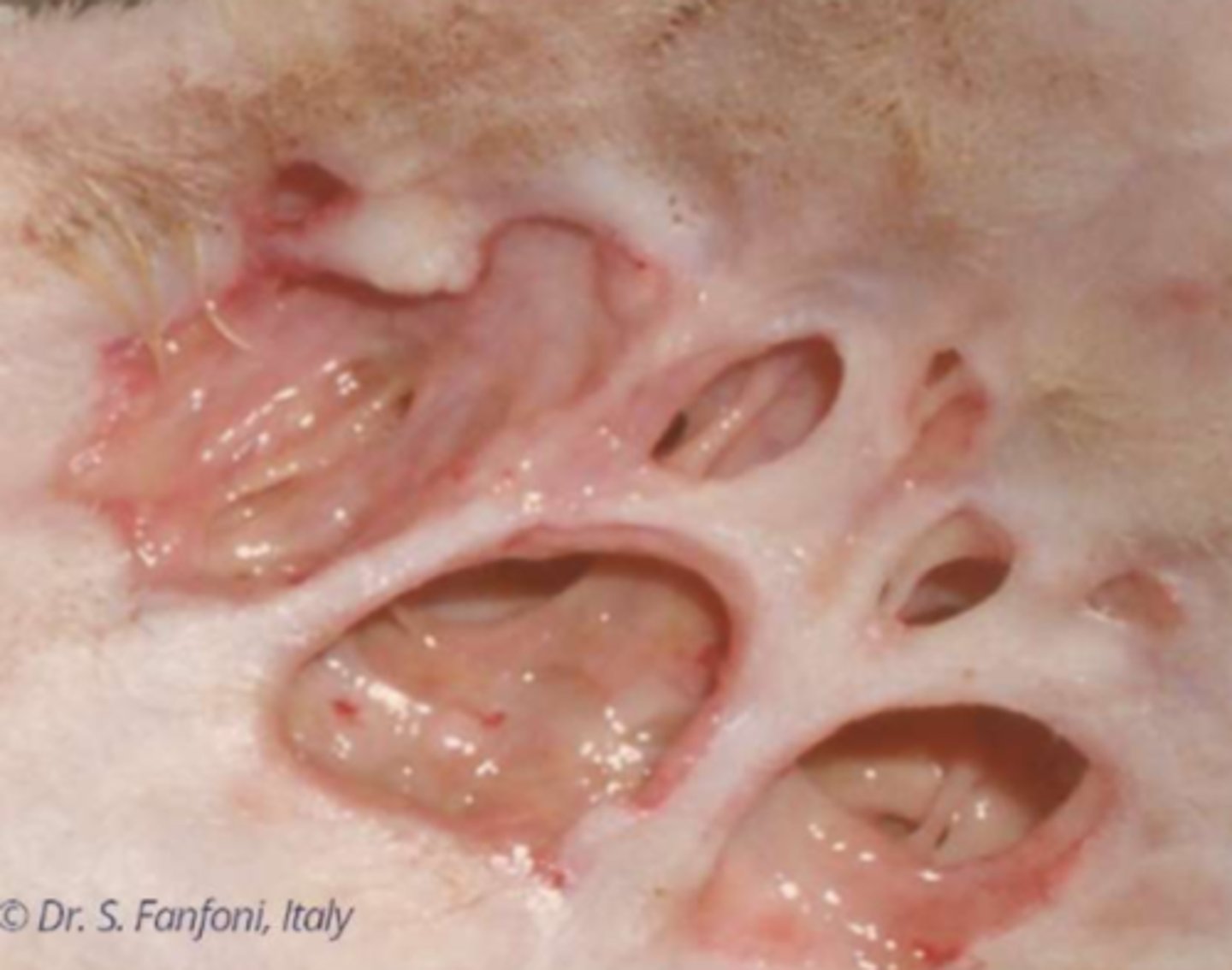 <p>¿lesión?</p><p>¿primaria o secundaria?</p>