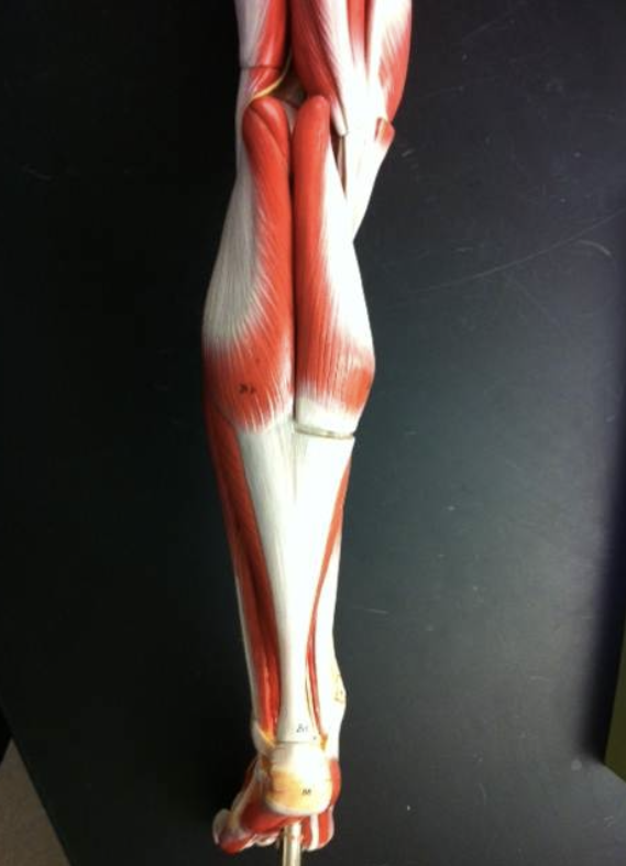 <p>The calf nicknamed the</p>