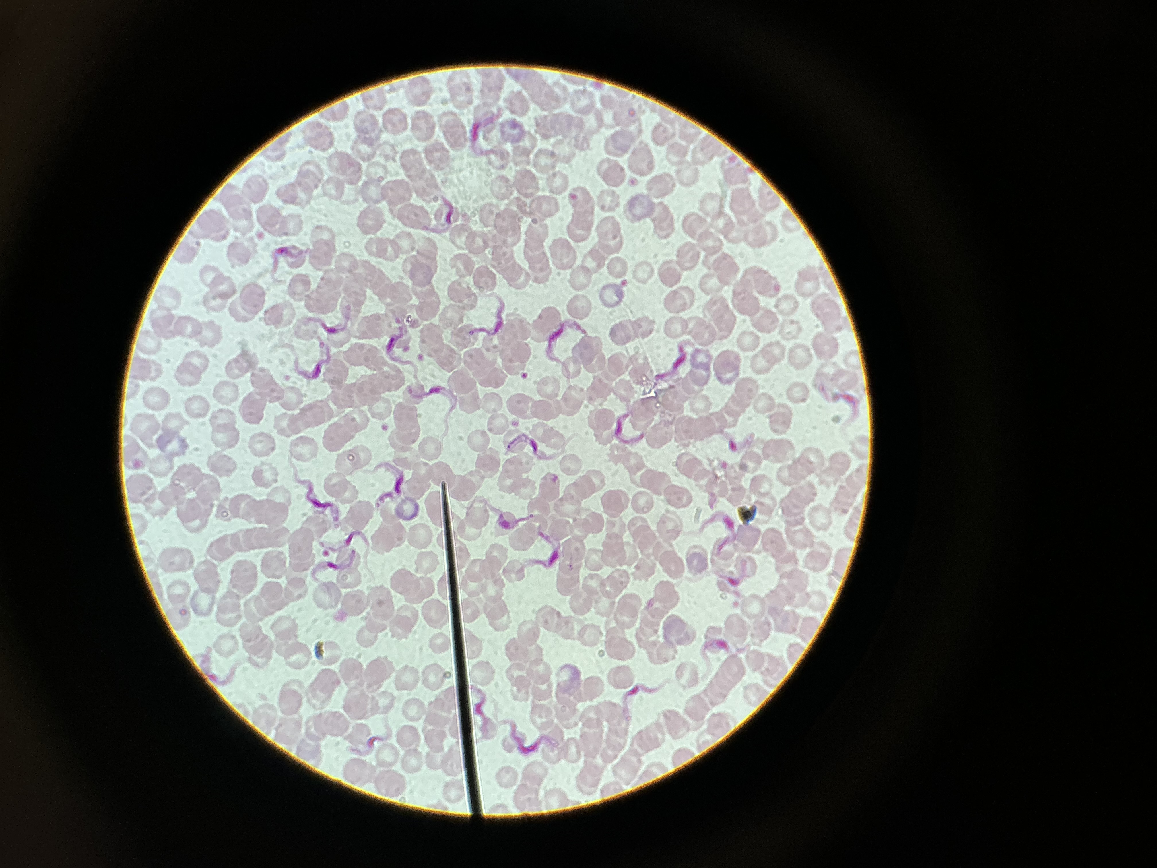 <p>Trypanosoma gambiense </p>