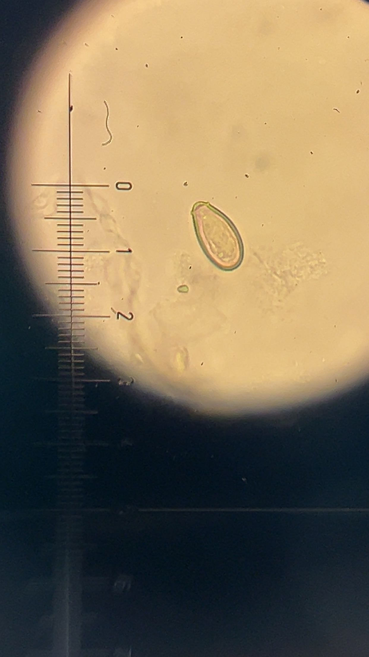 <p><em><span>Clonorchis sinensis</span></em><span> egg</span></p>