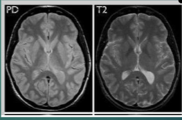 <p><span><span>What is an extrinsic factor of the following images?</span></span></p>